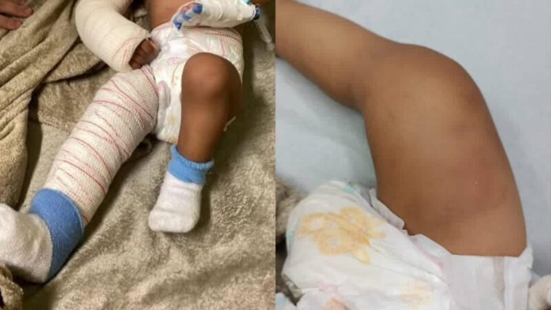 Bebê de 11 meses é espancado pela própria mãe e caso choca Santa Catarina